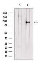 ABCB5 Antibody in Western Blot (WB)