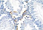 MRP1 Antibody in Immunohistochemistry (Paraffin) (IHC (P))