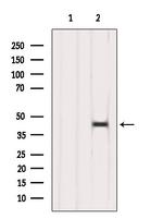 ACAA1 Antibody in Western Blot (WB)