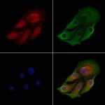 ACAA2 Antibody in Immunocytochemistry (ICC/IF)