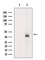 ACAA2 Antibody in Western Blot (WB)