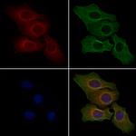 ACAP2 Antibody in Immunocytochemistry (ICC/IF)