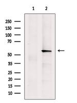 ASM Antibody in Western Blot (WB)