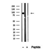 Aconitase 2 Antibody in Western Blot (WB)