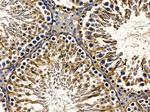 ACOX2 Antibody in Immunohistochemistry (Paraffin) (IHC (P))