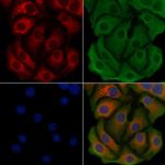 ACSL3 Antibody in Immunocytochemistry (ICC/IF)