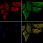 alpha Actinin 1/2/3/4 Antibody in Immunocytochemistry (ICC/IF)