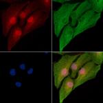 alpha-1b Adrenergic Receptor Antibody in Immunocytochemistry (ICC/IF)