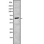 alpha-1b Adrenergic Receptor Antibody in Western Blot (WB)