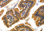 AGO1 Antibody in Immunohistochemistry (Paraffin) (IHC (P))