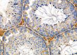 AGO1 Antibody in Immunohistochemistry (Paraffin) (IHC (P))