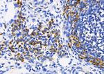 AKAP12 Antibody in Immunohistochemistry (Paraffin) (IHC (P))