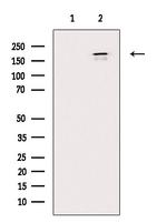 AKAP12 Antibody in Western Blot (WB)