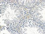 AKAP4 Antibody in Immunohistochemistry (Paraffin) (IHC (P))