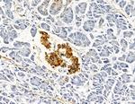 AKR1C1 Antibody in Immunohistochemistry (Paraffin) (IHC (P))