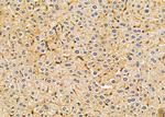 AKR1C1 Antibody in Immunohistochemistry (Paraffin) (IHC (P))