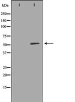 ALDH1A2 Antibody in Western Blot (WB)