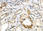 ALDH1A3 Antibody in Immunohistochemistry (Paraffin) (IHC (P))