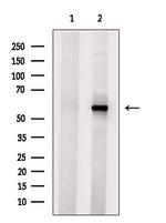 ALDH1A3 Antibody in Western Blot (WB)