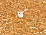 ALDH9A1 Antibody in Immunohistochemistry (Paraffin) (IHC (P))