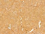 ALDH9A1 Antibody in Immunohistochemistry (Paraffin) (IHC (P))