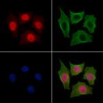 Anillin Antibody in Immunocytochemistry (ICC/IF)