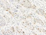 Anillin Antibody in Immunohistochemistry (Paraffin) (IHC (P))