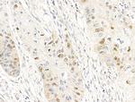 Anillin Antibody in Immunohistochemistry (Paraffin) (IHC (P))