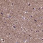 ANKRD26 Antibody in Immunohistochemistry (Paraffin) (IHC (P))