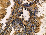 ANKRD26 Antibody in Immunohistochemistry (Paraffin) (IHC (P))