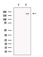 ANKRD26 Antibody in Western Blot (WB)