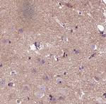 Protein APC Antibody in Immunohistochemistry (Paraffin) (IHC (P))