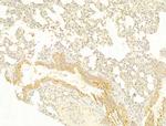 Protein APC Antibody in Immunohistochemistry (Paraffin) (IHC (P))