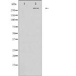 Protein APC Antibody in Western Blot (WB)