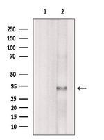 Aquaporin 9 Antibody in Western Blot (WB)