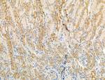 ARF1/ARF3/ARF5/ARF6 Antibody in Immunohistochemistry (Paraffin) (IHC (P))