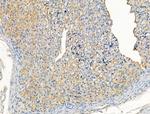 ARF1/ARF3/ARF5/ARF6 Antibody in Immunohistochemistry (Paraffin) (IHC (P))