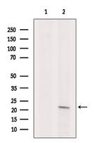 ARF1/ARF3/ARF5/ARF6 Antibody in Western Blot (WB)