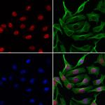 ARHGEF5 Antibody in Immunocytochemistry (ICC/IF)