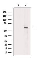 ARHGEF5 Antibody in Western Blot (WB)