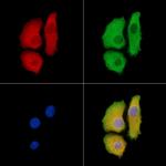 ASAP1 Antibody in Immunocytochemistry (ICC/IF)