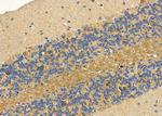 ASAP1 Antibody in Immunohistochemistry (Paraffin) (IHC (P))