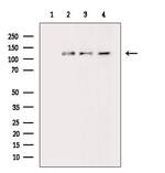 ASAP1 Antibody in Western Blot (WB)