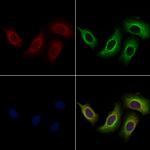 BASP1 Antibody in Immunocytochemistry (ICC/IF)