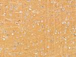 BASP1 Antibody in Immunohistochemistry (Paraffin) (IHC (P))