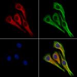 BCKDHA Antibody in Immunocytochemistry (ICC/IF)