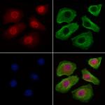 BCL-2 Antibody in Immunocytochemistry (ICC/IF)