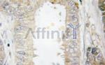 BCL-2 Antibody in Immunohistochemistry (Paraffin) (IHC (P))