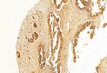 BCL-2 Antibody in Immunohistochemistry (Paraffin) (IHC (P))