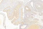 BCL-2 Antibody in Immunohistochemistry (Paraffin) (IHC (P))